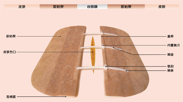无针缝合器