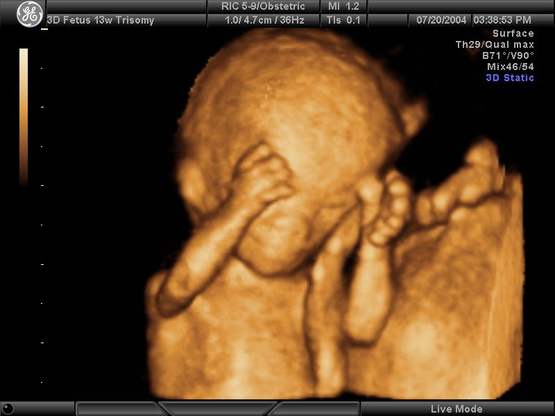 4D Color Doppler Ultrasound TH-5500 photo