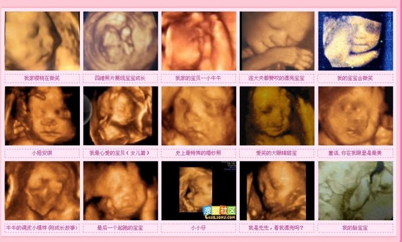 4D Color Doppler Ultrasound TH-5500 photo