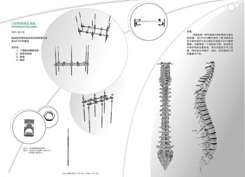 Spinal Internal Fixation Series photo